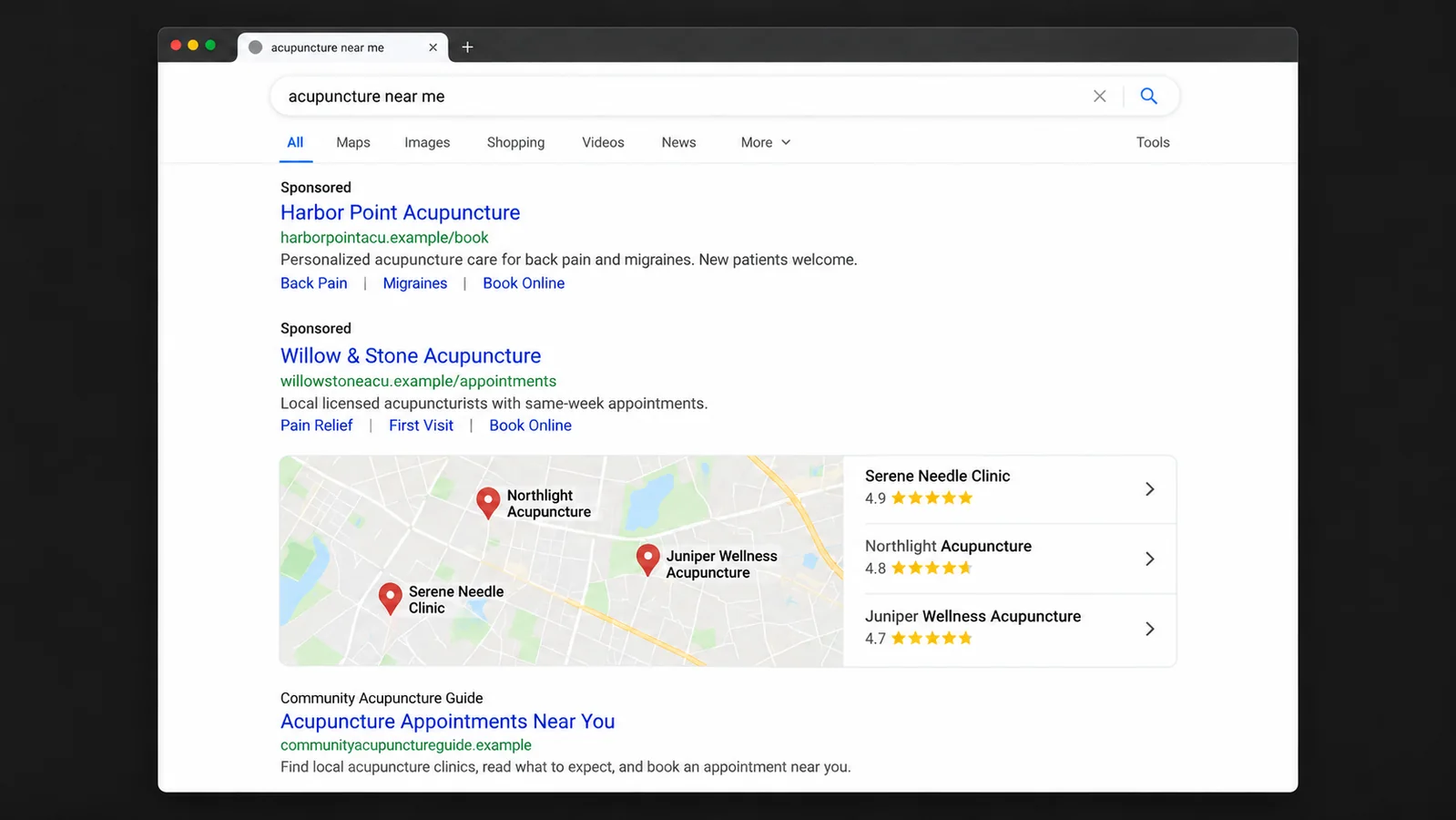 Illustrative search results for acupuncture near me showing sponsored listings, a local map pack, and an organic result